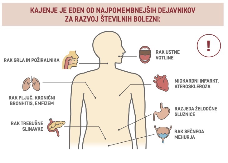 Razvoj bolezni, povezanih s kajenjem : rak grla in požiralnika, rak pljuč, kronični bronhitis. emfizem, rak trebušne slinavke, rak ustne votline, rak sečnega mehurja, miokardni infarkt, razjeda želodčne sluznice., 