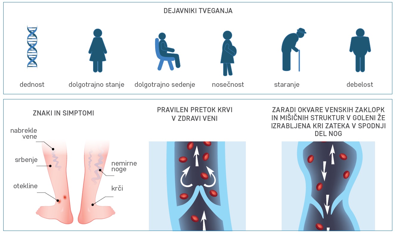 Dejavniki tveganja : dednost, dolgotrajno stanje, dogotrajno sedenje, nosečnost, staranje, debelost