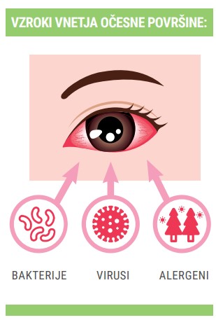 Vzroki za vnetje očesne površine : bakterije, virusi, alergeni