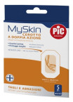 Pic My Skin, 5 obližev za roke