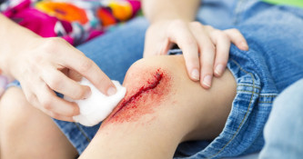 Kako pravilno oskrbeti poškodovano kožo